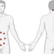 diagram of human body undergoing clinical trial